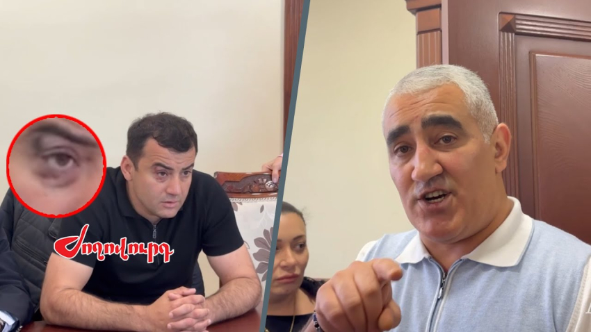ՏԵՍԱՆՅՈՒԹ․ «Ես ինձ պահել եմ նորմալ հայի նման»․ Մասիվի թաղապետը արդարանում է Չախոյանին դաժանաբար ծեծելուց հետո